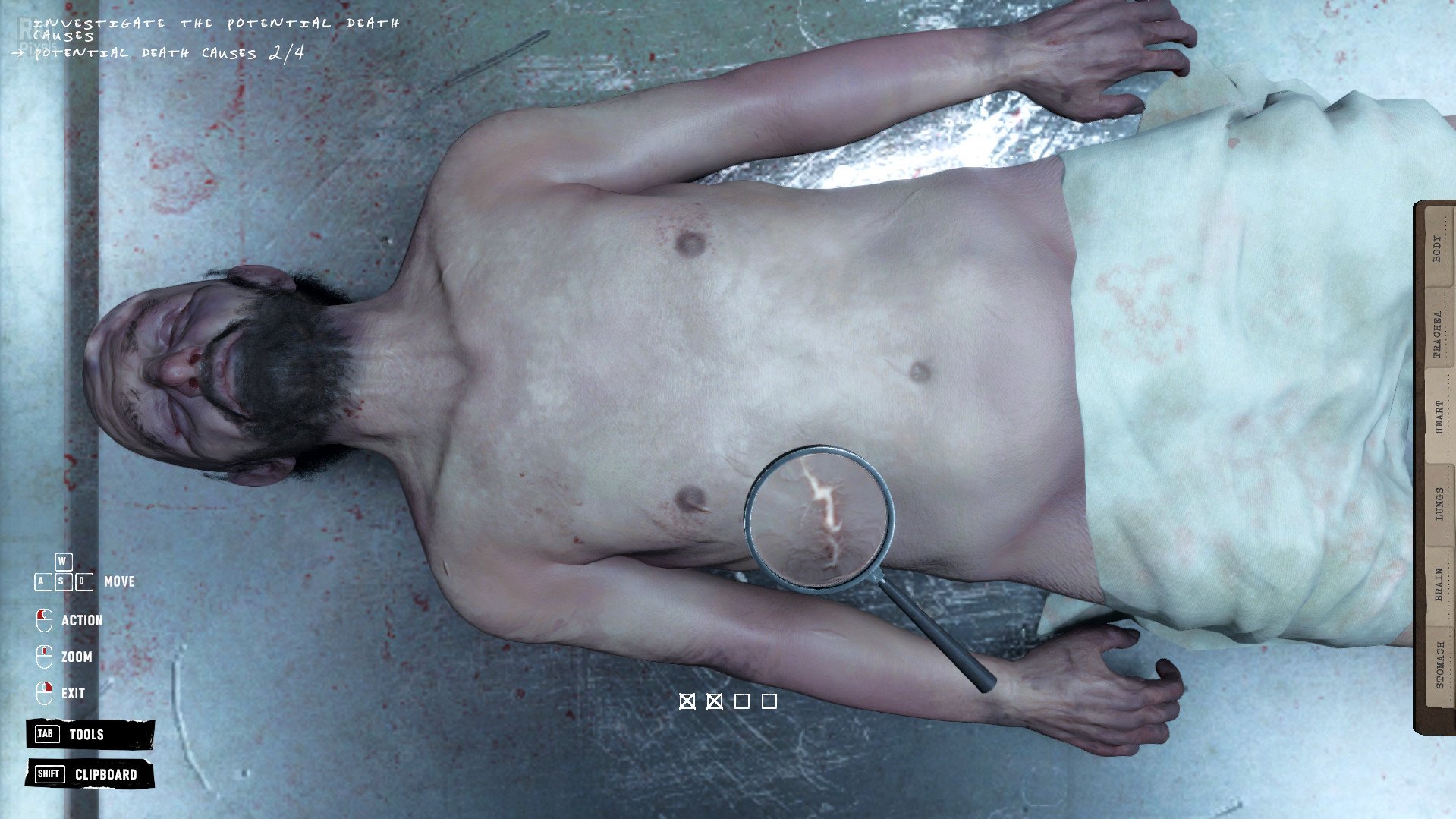 [9]-Autopsy Simulator Download