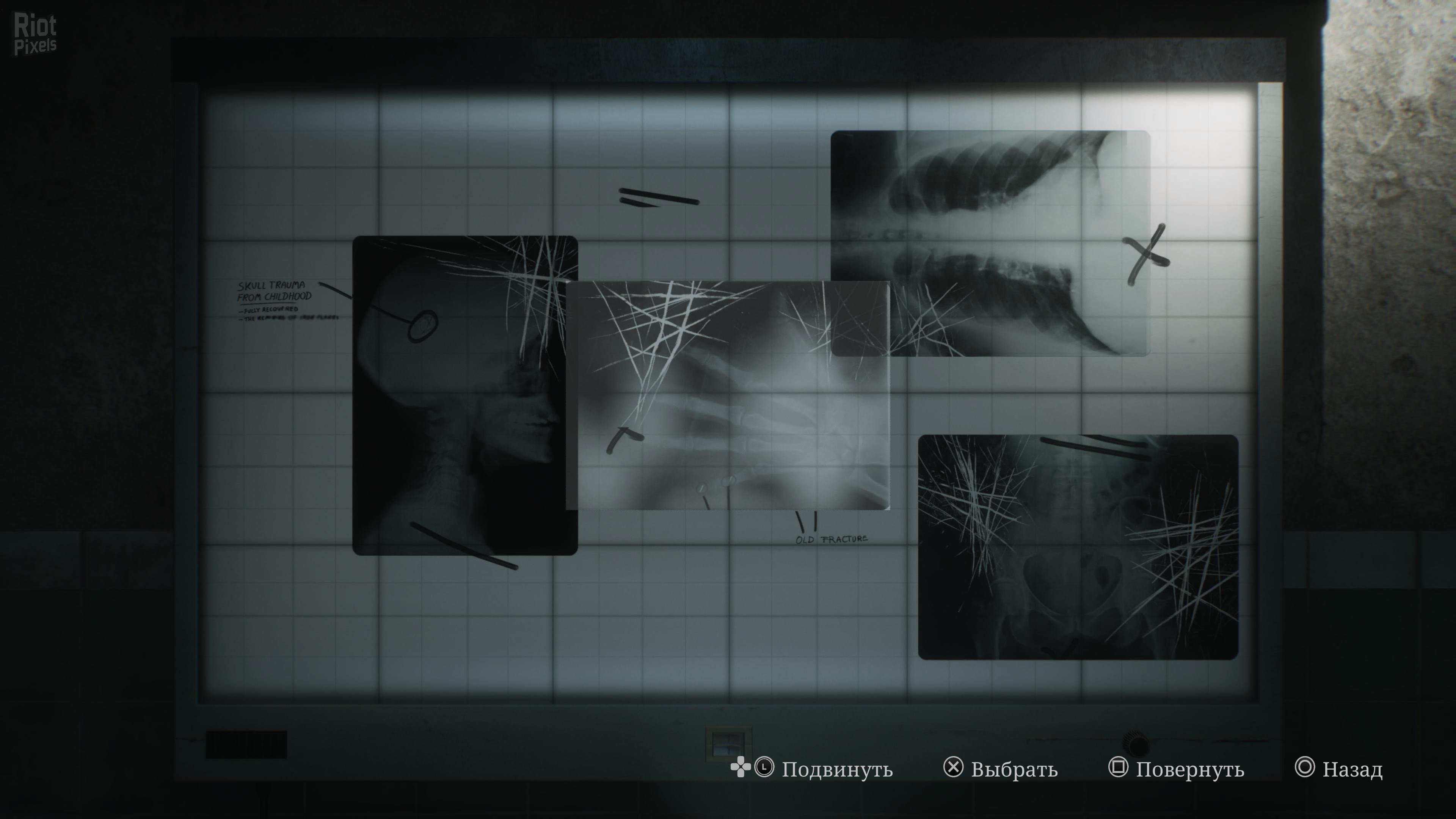 [4]-Silent Hill 2: Digital Deluxe Edition – v1.1.236.114 + 4 DLCs/Bonuses Download